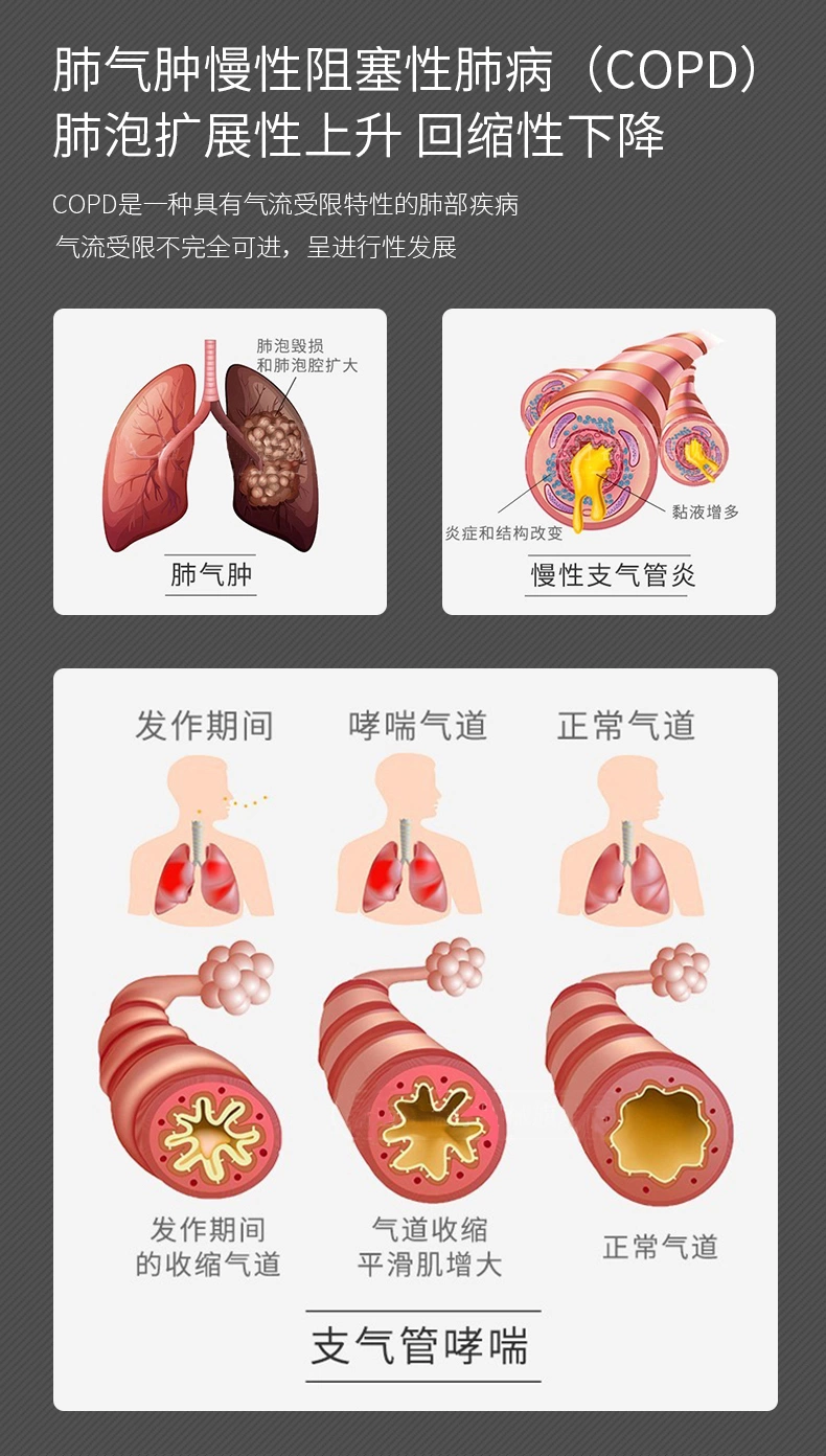 瑞迈特G3B30VT模式排二氧化肺部